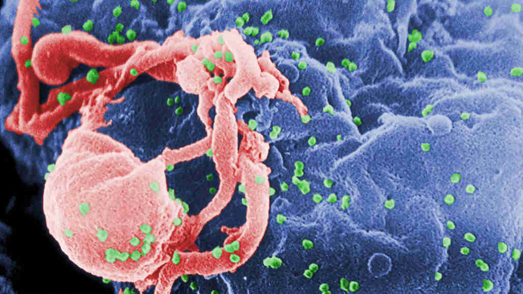 首先，一个人的免疫系统艾滋病毒 - 并赢了