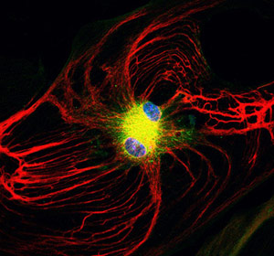 干细胞研究揭示了星形胶质细胞的脑保护力