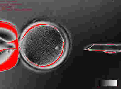 科学家将人体皮肤细胞转化为胚胎干细胞