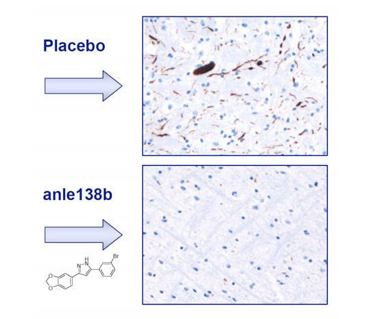 Anle138b减慢了帕金森病的发病和进展