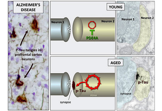 神经生物学家揭示了与阿尔茨海默病的关键问题有关的与年龄相关的变化