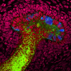 研究人员从人干细胞产生肾结构
