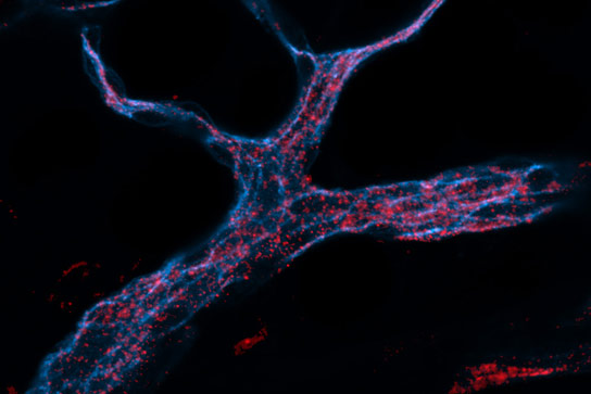 RNA携带的纳米粒子以高效率将siRNA递送至内皮细胞