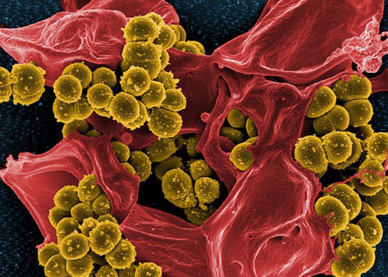加州大学圣地亚哥分校的生物学家开发了鉴定抗生素的新方法