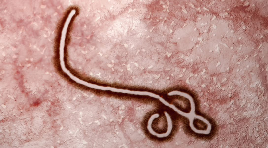 21天隔离可能不足以防止埃博拉病毒传播