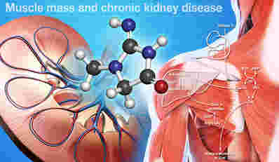肌肉质量和慢性肾病