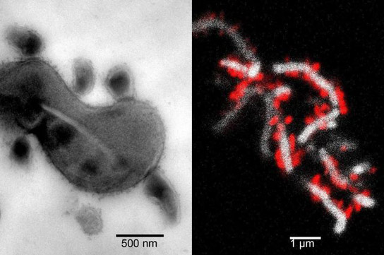 科学家们揭示了“微生物暗物质”可能引起疾病的新光线