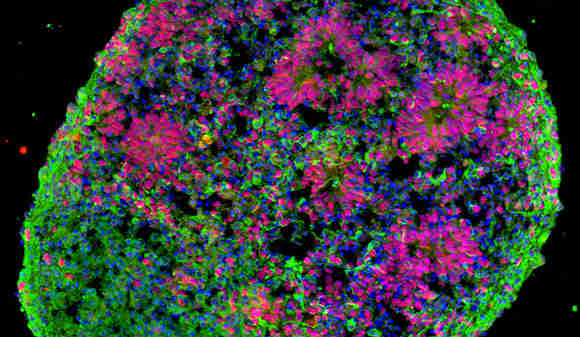 新的干细胞研究可能导致新药治疗的新药物目标