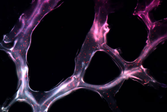 科学家们开发出一种新的方法来提供用于治疗癌症的MicroRNA