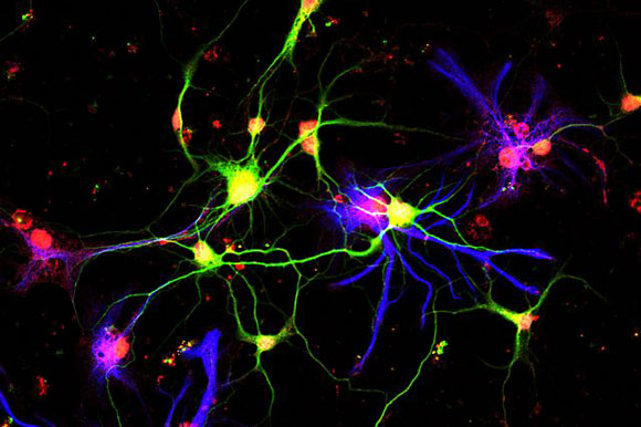 GDF10促进脑细胞的形成新联系能力