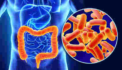 耶鲁大学研究表明蛋白质IL-18导致结肠炎