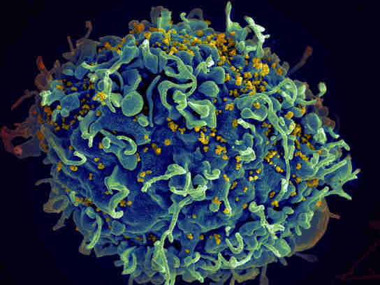 新发现为艾滋病毒疫苗种系靶标免疫原提供了一种设计