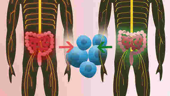 新研究显示人类肠道可以引发多发性硬化症