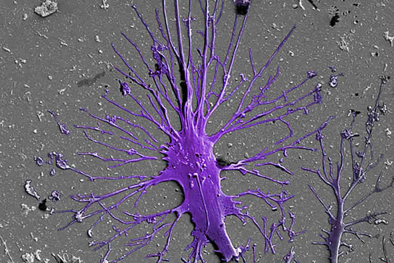 研究人员使用人干细胞来创造人肾肾小球的模型