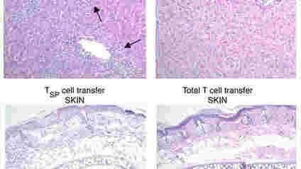 新的T细胞亚群可能会改善癌症的细胞疗法