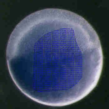 耶鲁科学家追踪胚胎的发展