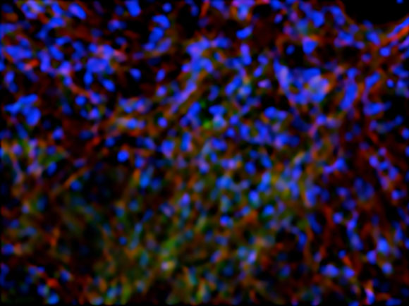 UCSD研究人员使用腺苷来指挥干细胞来构建新骨骼