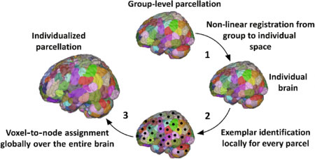 神经科学家可以通过分析神经元联系来预测智商