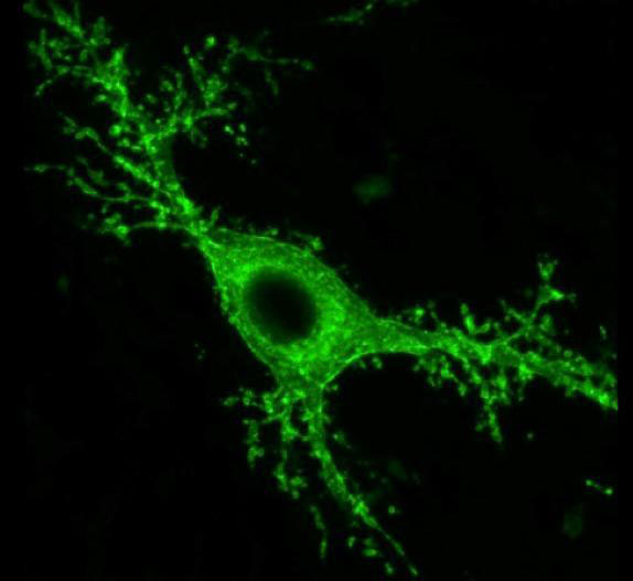 苔藓脑细胞与记忆损失和癫痫发作相关联