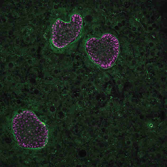 新的突破使生物学家能够成长和测试患有疟疾的休眠形式