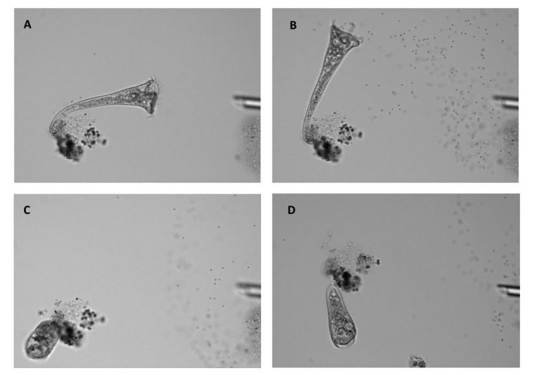 视频显示了单细胞生物做出复杂的决定–解决了有百年历史的科学辩论