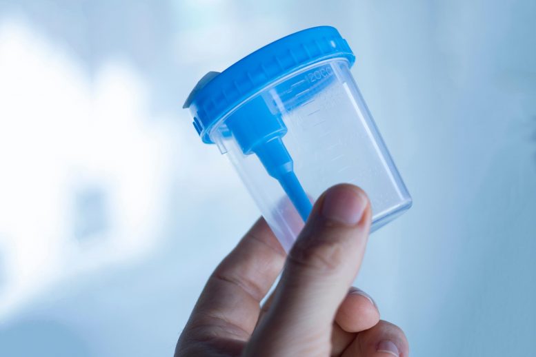 简单的家庭尿液检查可以彻底改变前列腺癌的诊断
