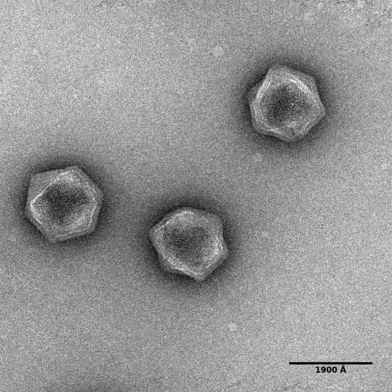 病毒暗物质：巨型病毒具有代谢基因 - 尽管病毒没有新陈代谢