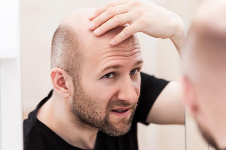 基于干细胞的新型局部解决方案可帮助秃头人恢复头发生长