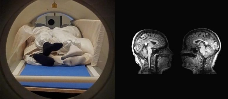 如何在大脑中感到触摸 - 用双人MRI扫描对夫妻进行了调查