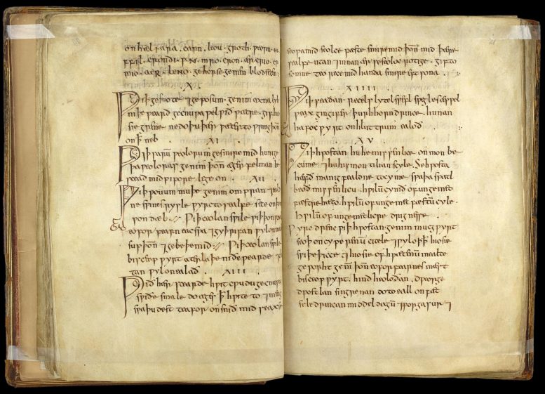 中世纪医学补救措施 - 在9世纪发现Bald的Leechbook  - 可以为现代感染提供新的治疗方法
