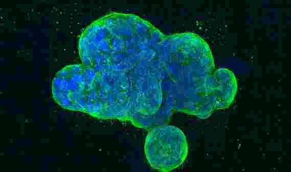 “合成致死性” - 利用癌症特异性遗传缺陷靶向癌症