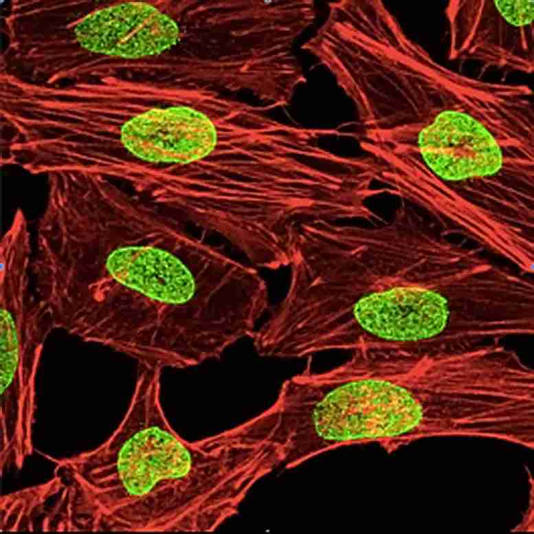 科学家通过“关上细胞核”杀死癌细胞-可能导致新型癌症治疗
