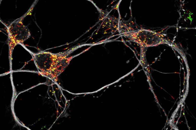 代谢重新兴奋：具有节能计划的神经细胞