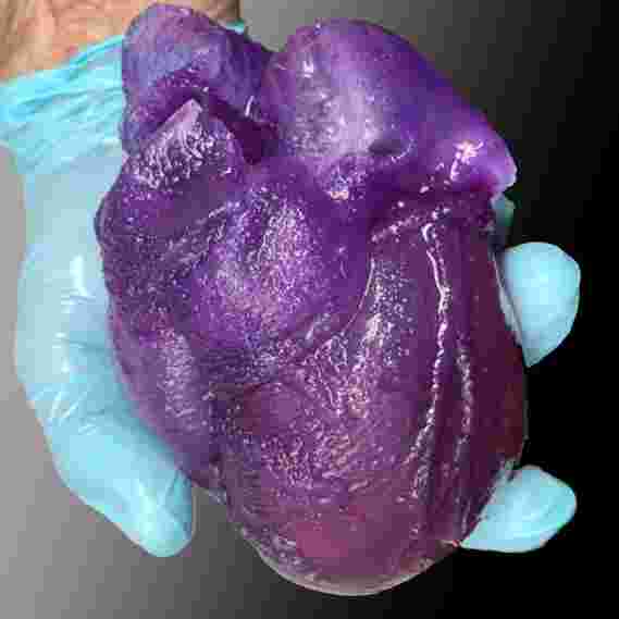 新的外科医生工具：3D生物打印心脏