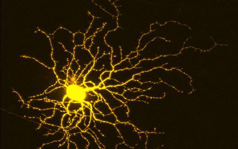将神经变性疾病从青光眼治疗到Alzheimer：关于如何保护神经元并鼓励其增长的新发现